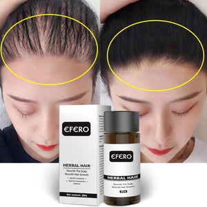 2019 Natural Ginger Hair Loss Essence Oil Effective Dense Hair Growth Essential Liquid 20ml Prevent Baldness Care Serum TSLM2