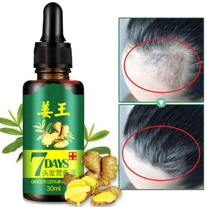 Ginger Germinal Serum Nutrient Essence Oil Natural Hair Loss Treatement Effective Fast Growth Hair Care 30ML