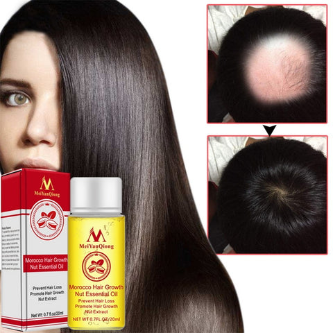 High Quality2019 Powful Hair Growth Products Ginger Faster Grow Hair Shampoo Stop Hair Loss Treatment Hair Care